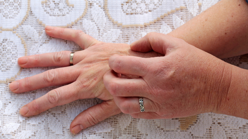 Torr hud och klåda – långvarig klåda hos äldre ett bekymmer